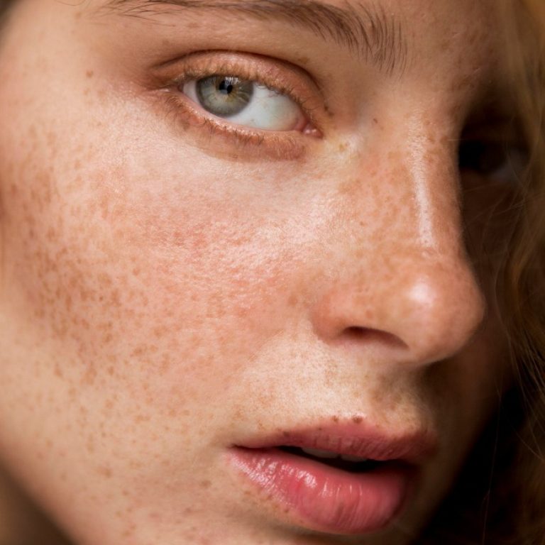Pigmentation